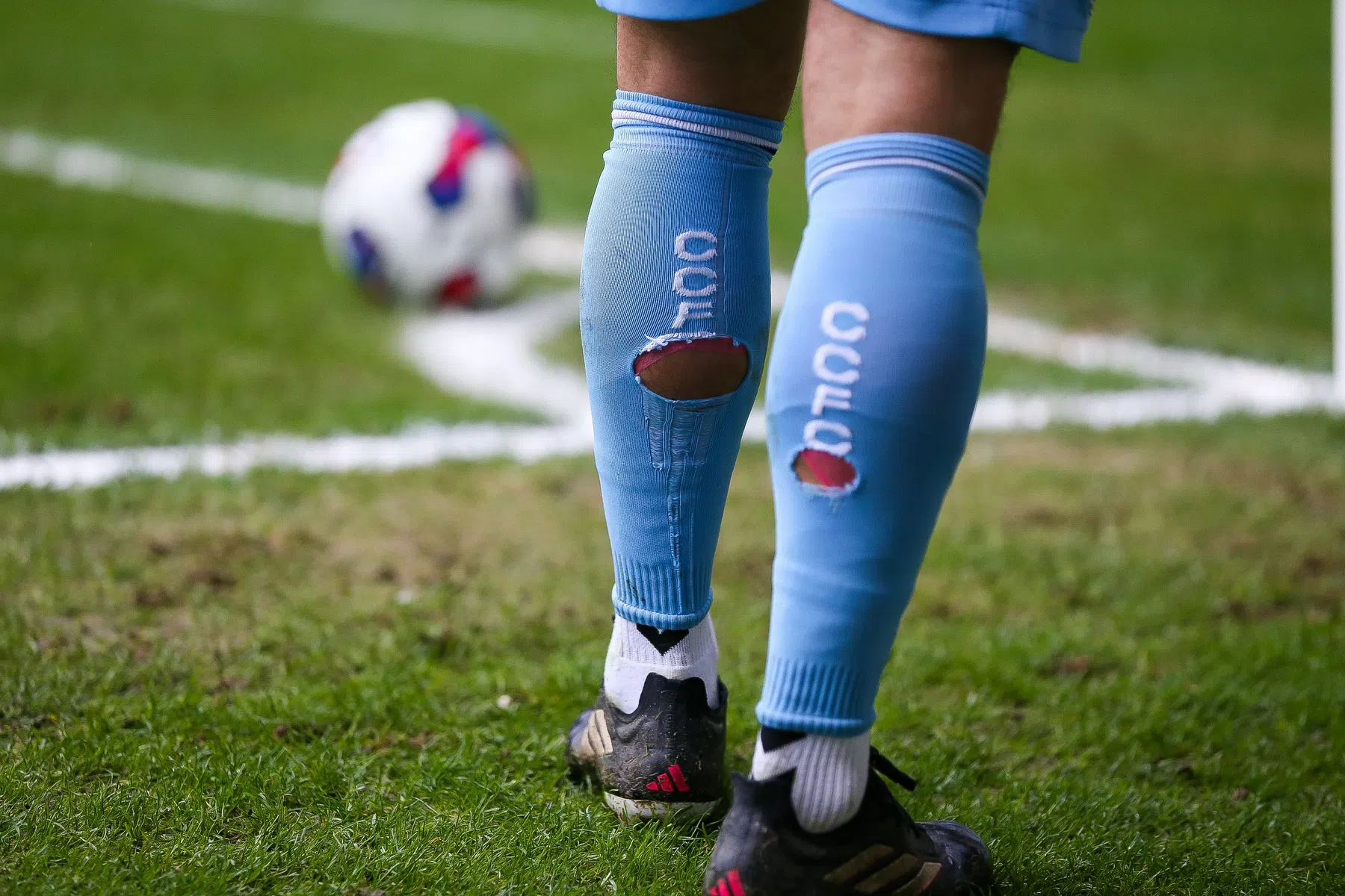 gaten in voetbalsokken