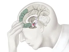 Thumbnail for article: Brain Fog: oorzaken, symptomen en oplossingen