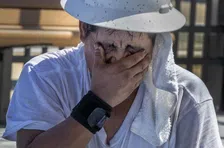 Thumbnail for article: Hyperhidrose: alles over overmatig zweten en hoe je het kunt stoppen