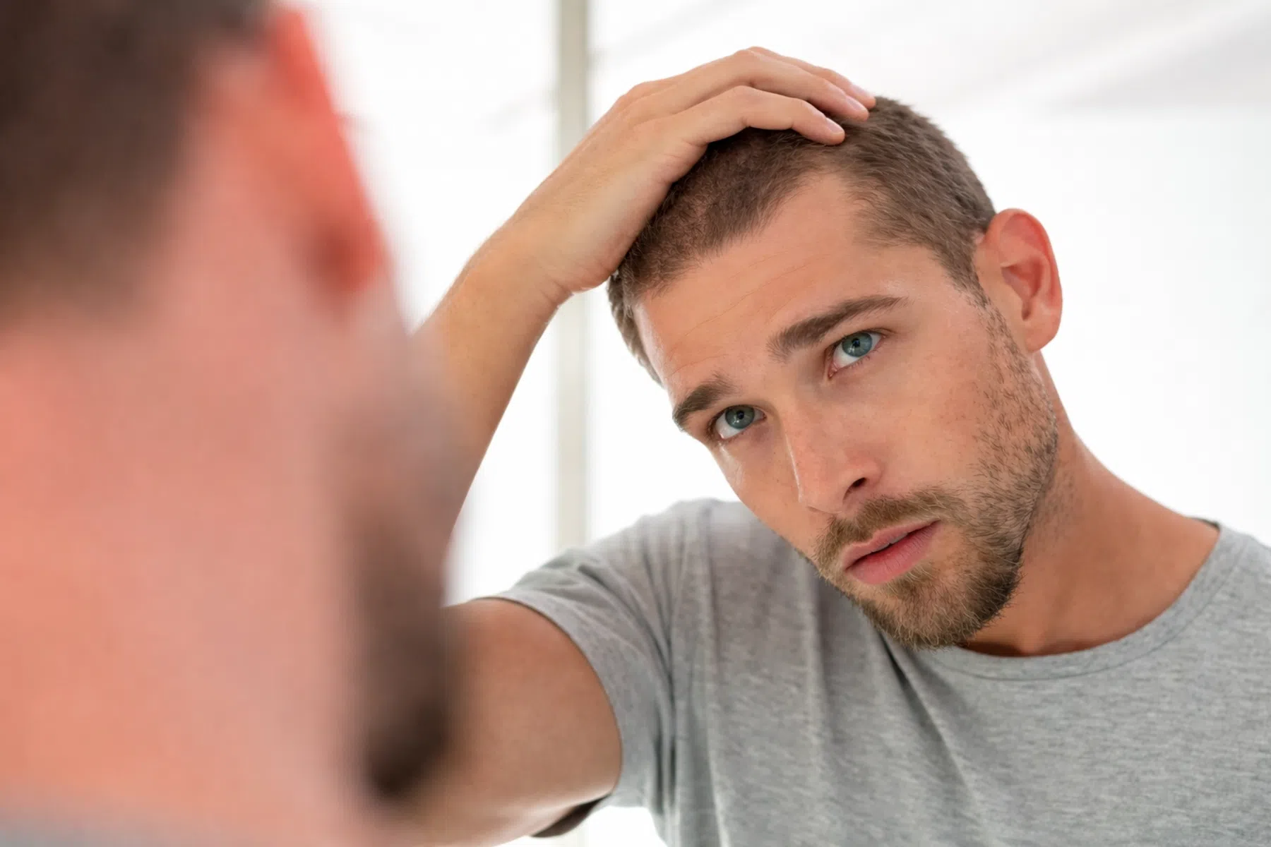 Haaruitval bij mannen: dit zijn de beste oplossingen